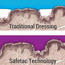 Mepilex Foam Wound Dressings Guide|Express Medical Supply