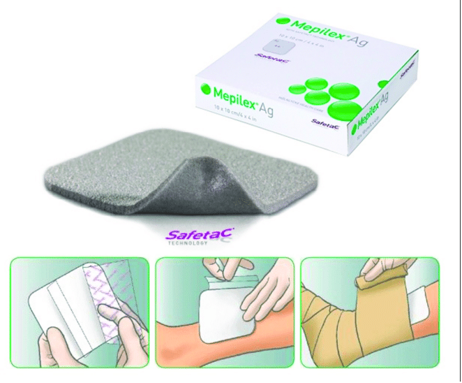 Mepilex ® Ag with instructions for application. Images used with... |  Download Scientific Diagram