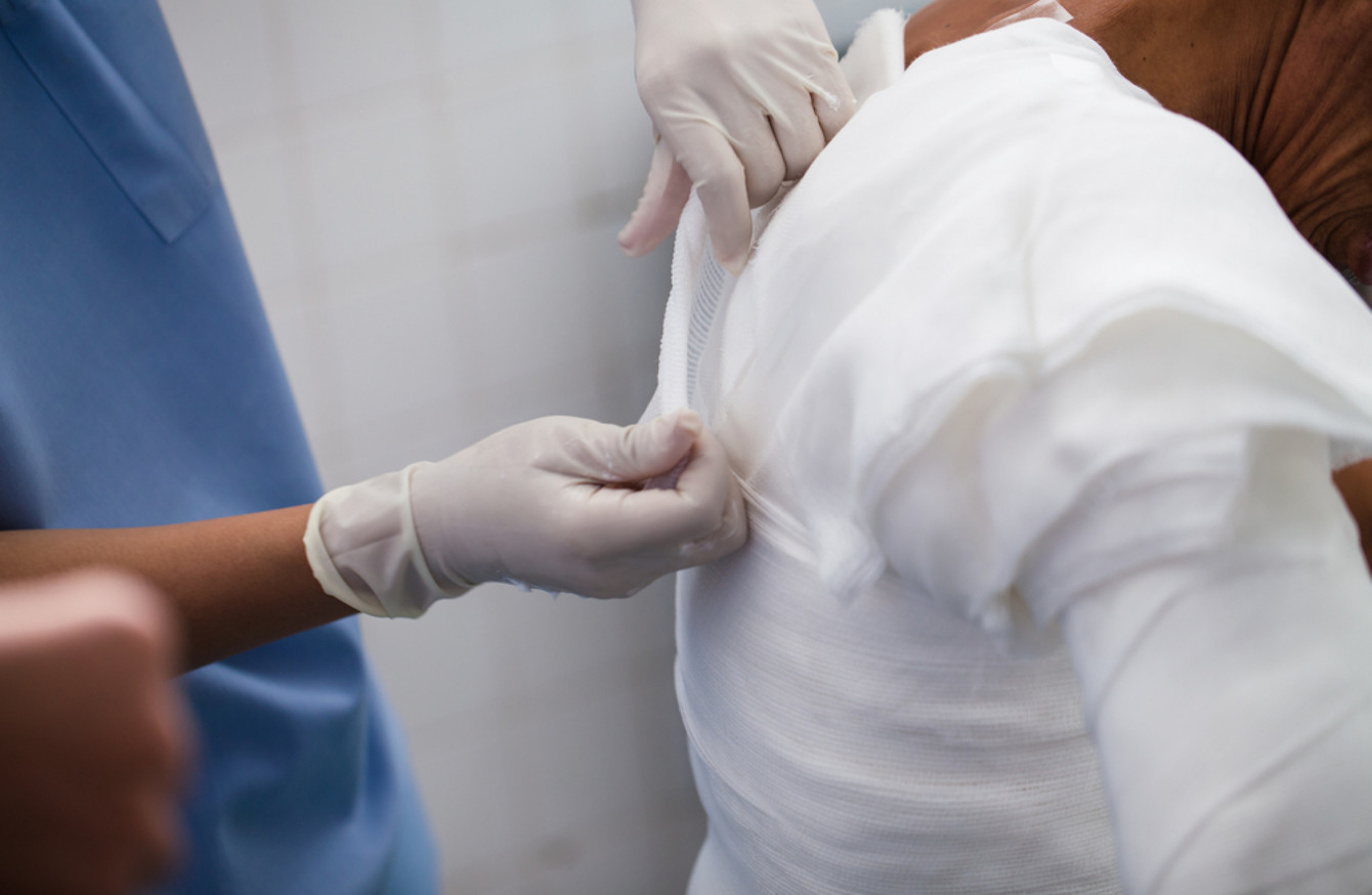 درمان زخم   بیمار 41 درصد سوختگی درجه 2