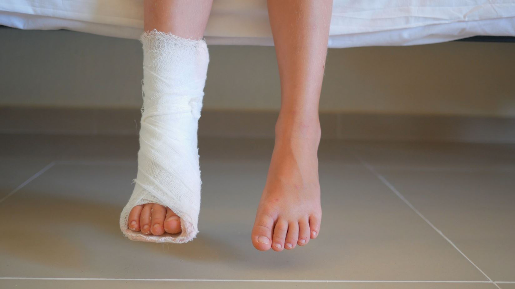 نمونه درمان شده زخم پای دیابتی