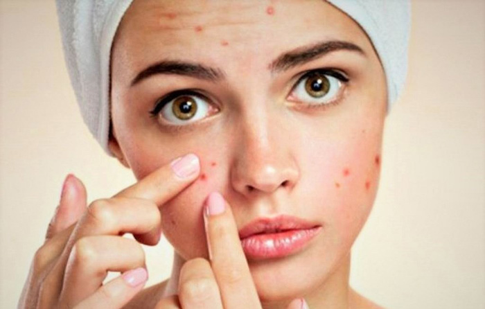 رژیم غذایی مناسب برای زیبایی انواع پوست