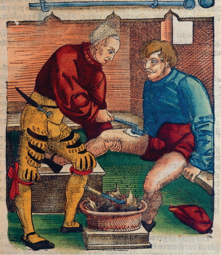 پانسمان نوین چیست؟