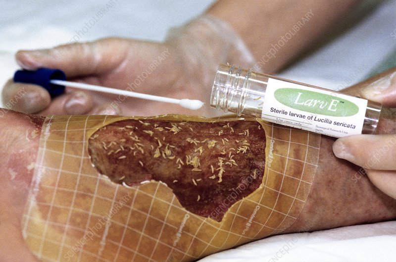 ماگوت تراپی یا لارو درمانی