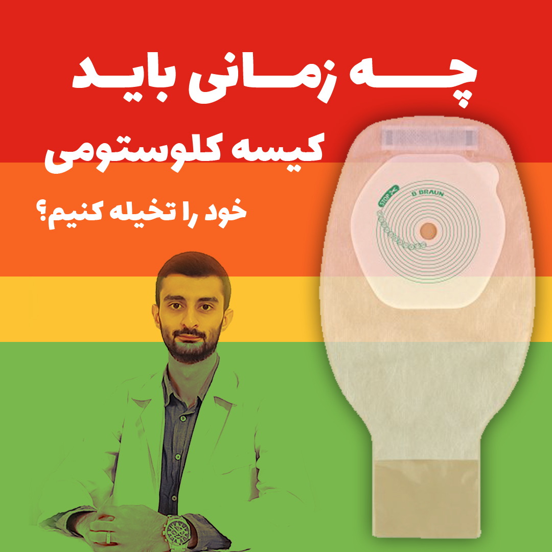 چه زمانی باید کیسه کلوستومی ته باز را تخلیه کنیم؟