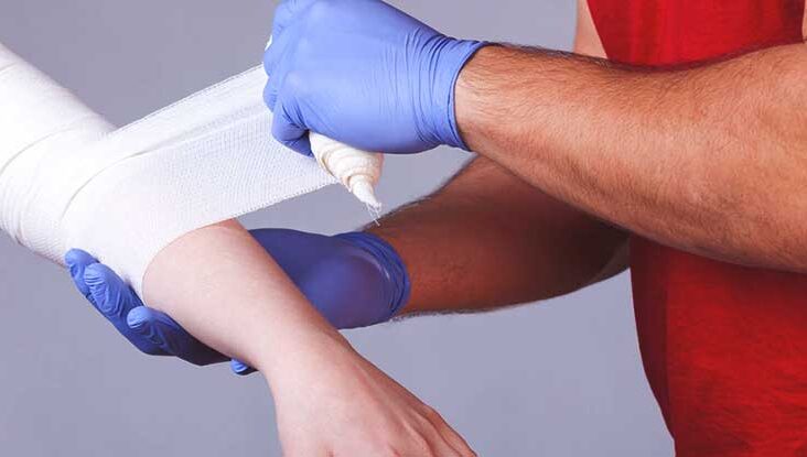 درمان سوختگی با آب جوش