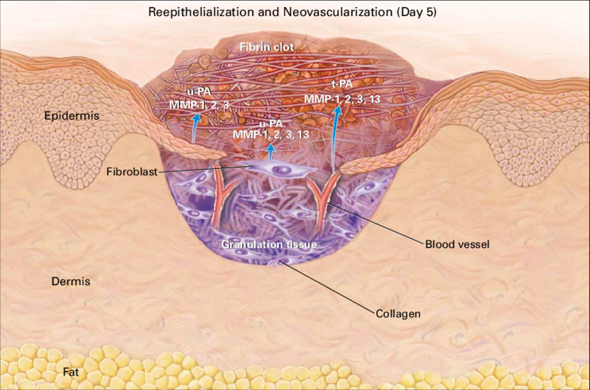 انواع بافت زخم