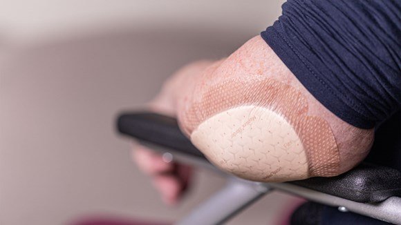 چگونه می توان از بروز زخم بستر پیشگیری نمود؟